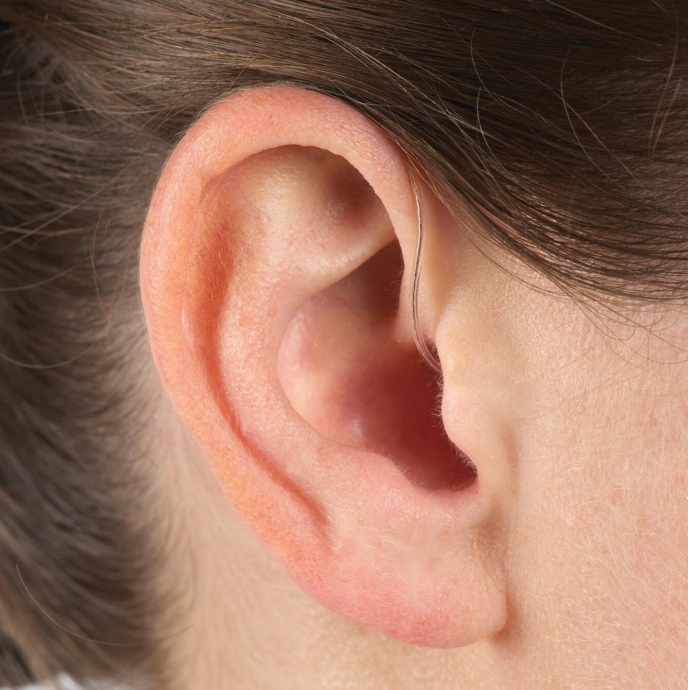 RITE- Receiver in the ear