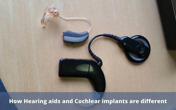 How Hearing aids and cochlear implants are different-art